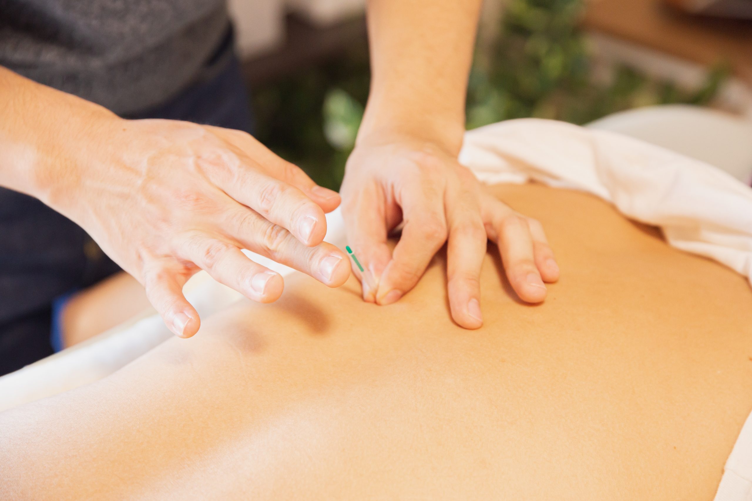 Comment acupuncture peut aider votre corps